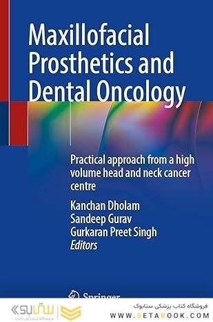Maxillofacial Prosthetics and Dental Oncology: Practical approach from a high volume head and neck cancer centre