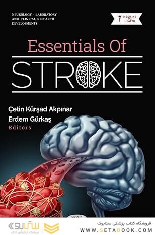 Essentials of Stroke