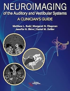 عکس Neuroimaging of the Auditory and Vestibular Systems: A Clinician’s Guide 1st Edition