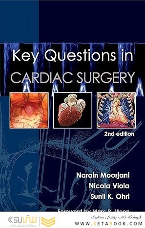 Key Questions in Cardiac Surgery