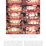 Contemporary Orthodontics 7th Edition