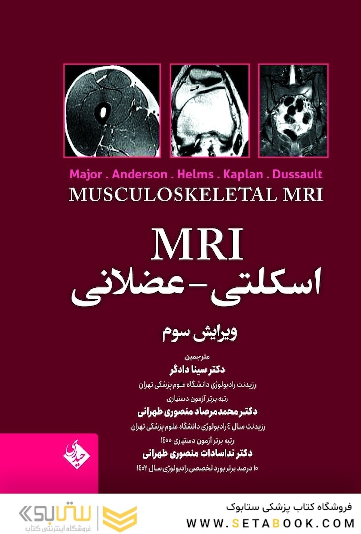MRI اسکلتی - عضلانی