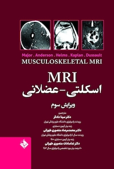 عکس MRI اسکلتی - عضلانی