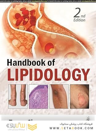 Handbook of Lipidology