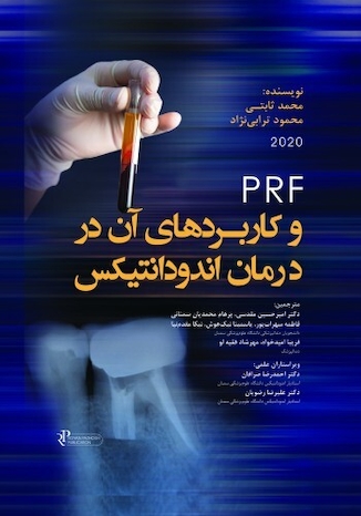 عکس PRF و کاربردهای آن در درمان اندودانتیکس