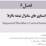 درمان ارتودنسی دندان های نهفته (فصول برگزیده آزمون های ارتقا و بورد)
