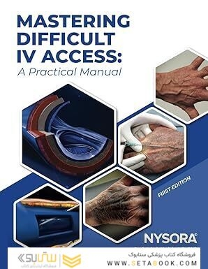 Mastering Difficult IV Access - a Practical Manual: First Edition