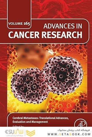 Cerebral Metastases: Translational Advances, Evaluation and Management
