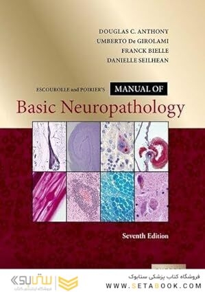 Escourolle and Poirier