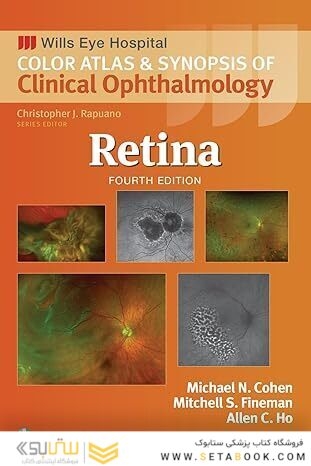 Retina (Wills Eye Institute Atlas Series) 4th Edition
