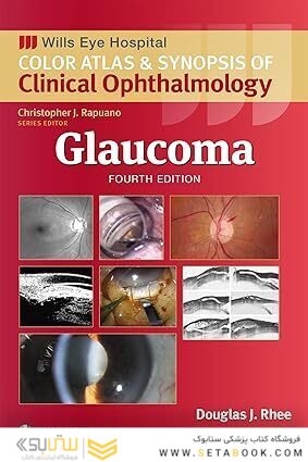 Glaucoma (Wills Eye Institute Atlas Series) 4th Edition