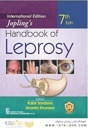 Joplings Handbook Of Leprosy 7Ed International Edition