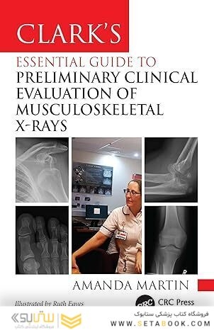 Clark’s Essential Guide to Preliminary Clinical Evaluation of Musculoskeletal X-rays: Evaluating and Commenting on Images