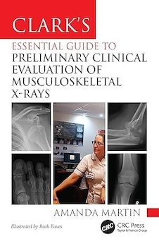 عکس Clark’s Essential Guide to Preliminary Clinical Evaluation of Musculoskeletal X-rays: Evaluating and Commenting on Images