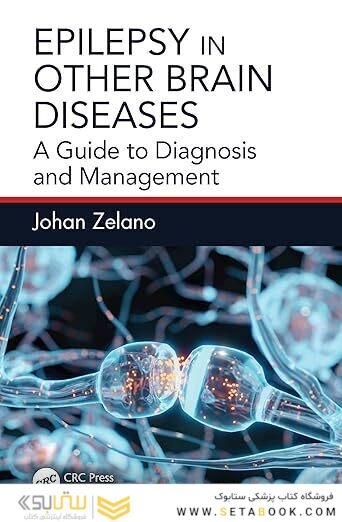 Epilepsy in Other Brain Diseases: A Guide to Diagnosis and Management 1st Edition