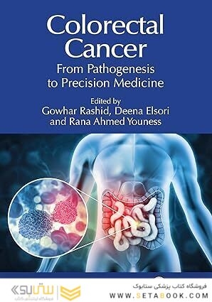 Colorectal Cancer: From Pathogenesis to Precision Medicine 1st Edition