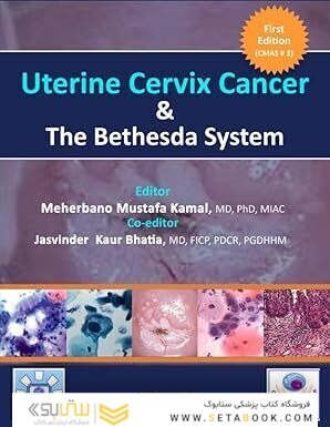 Uterine Cervix Cancer The Bethesda System