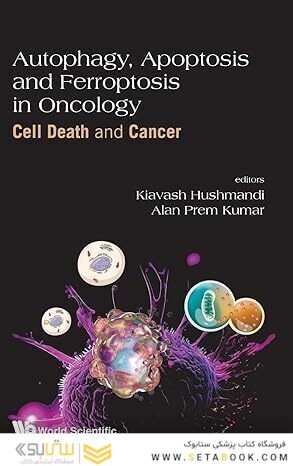 Autophagy, Apoptosis and Ferroptosis in Oncology: Cell Death and Cancer