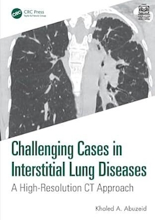 عکس Challenging Cases in Interstitial Lung Diseases: A High-resolution Ct Approach