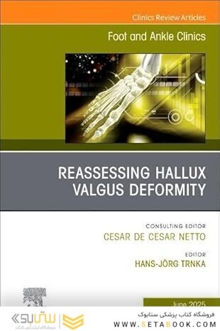 Reassessing Hallux Valgus Deformity, An issue of Foot and Ankle Clinics of North America