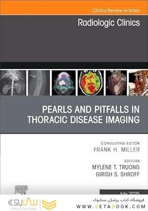 Pearls and Pitfalls in Thoracic Disease Imaging, An Issue of Radiologic Clinics of North America