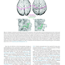 Cerebral Asymmetries