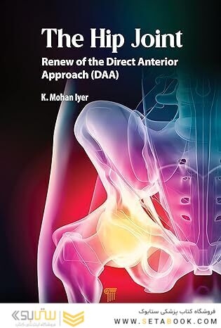 The Hip Joint