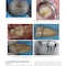 Diagnosis and Treatment Planning in Dentistry 4th Edition 2024