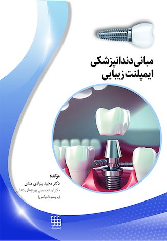 عکس مبانی دندانپزشکی ایمپلنت زیبایی