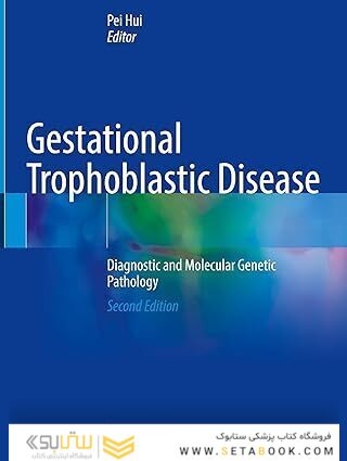 Gestational Trophoblastic Disease: Diagnostic and Molecular Genetic Pathology Second Edition