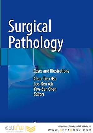 Surgical Pathology: Cases and Illustrations