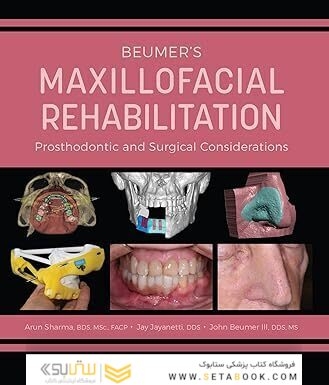 Beumer