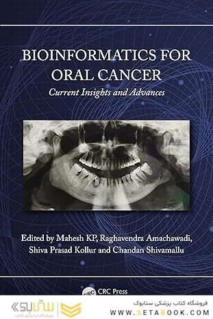 Bioinformatics for Oral Cancer: Current Insights and Advances 1st Edition