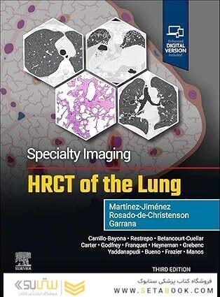 Specialty Imaging: HRCT of the Lung 3rd Edition
