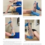 Atlas of Orthoses and Assistive Devices 6th Edition