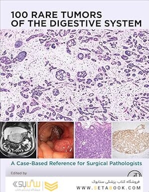 100 Rare Tumors of the Digestive System: A Case-based Reference for Surgical Pathologists