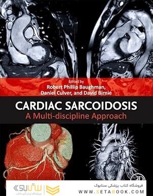 Cardiac Sarcoidosis: A Multi-discipline Approach 1st Edition