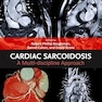 Cardiac Sarcoidosis: A Multi-discipline Approach 1st Edition