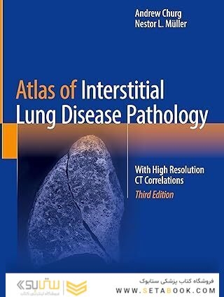 Atlas of Interstitial Lung Disease Pathology: With High Resolution CT Correlations Third Edition