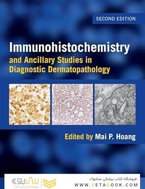 Immunohistochemistry and Ancillary Studies in Diagnostic Dermatopathology 2nd Edition