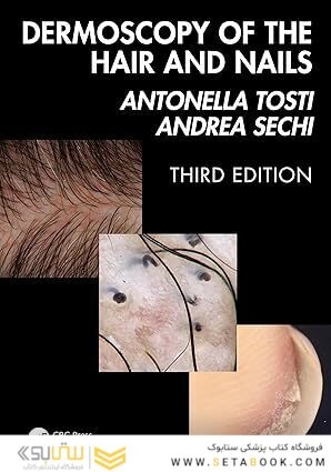 Dermoscopy of the Hair and Nails  3rd Edition