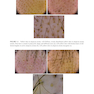 Dermoscopy of the Hair and Nails  3rd Edition