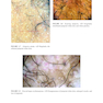 Dermoscopy of the Hair and Nails  3rd Edition