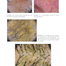 Dermoscopy of the Hair and Nails  3rd Edition
