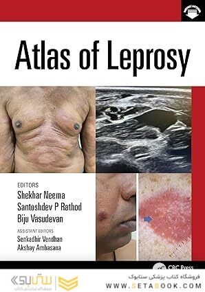 Atlas of Leprosy 1st Edition