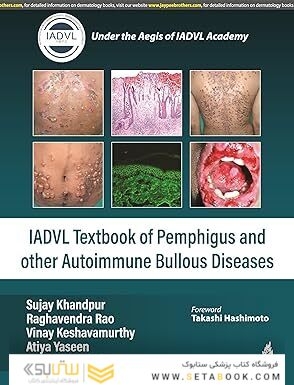 IADVL TEXTBOOK OF PEMPHIGUS AND OTHER AUTOIMMUNE BULLOUS DISEASES