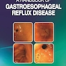 A Handbook of Gastroesophageal Reflux Disease