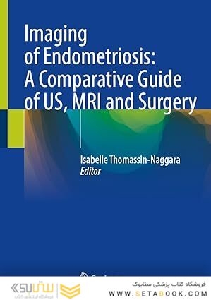Imaging of Endometriosis: A Comparative Guide of US, MRI and Surgery