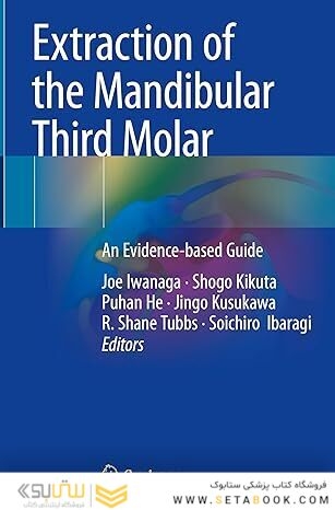 Extraction of the Mandibular Third Molar: An Evidence-based Guide