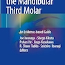 Extraction of the Mandibular Third Molar: An Evidence-based Guide